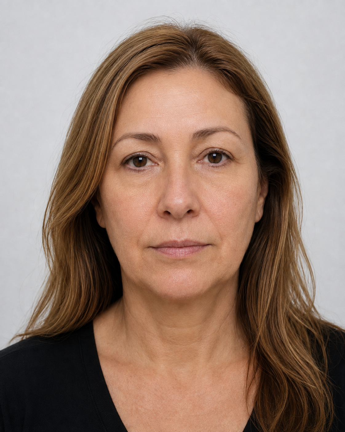 Resultado depois - Rejuvenescimento